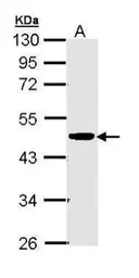 Anti-CKMT2 antibody [N2C3] used in Western Blot (WB). GTX111620