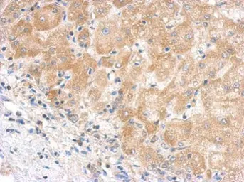 Anti-C5 / C5b antibody [C2C3-2], C-term used in IHC (Paraffin sections) (IHC-P). GTX111625