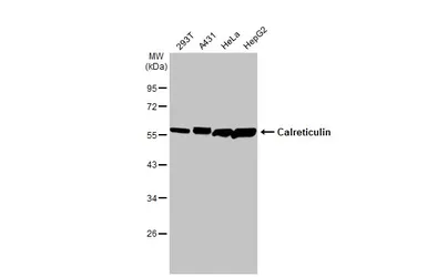 Anti-Calreticulin antibody used in Western Blot (WB). GTX111627