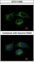 Anti-Caspase 1 antibody used in Immunocytochemistry/ Immunofluorescence (ICC/IF). GTX111630