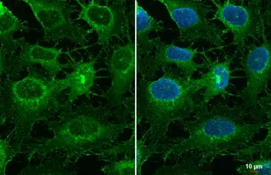 Anti-Collagen III antibody [C2C3-2], C-term used in Immunocytochemistry/ Immunofluorescence (ICC/IF). GTX111643