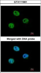 Anti-MSH6 antibody [C1C2], Internal used in Immunocytochemistry/ Immunofluorescence (ICC/IF). GTX111661