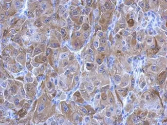 Anti-Transglutaminase 2 antibody [N1N3] used in IHC (Paraffin sections) (IHC-P). GTX111701