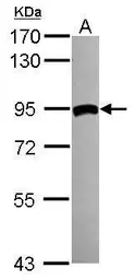 Anti-Transglutaminase 2 antibody [N1N3] used in Western Blot (WB). GTX111701