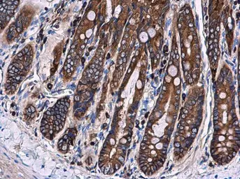 Anti-Ezrin antibody [N2C2], Internal used in IHC (Paraffin sections) (IHC-P). GTX111709