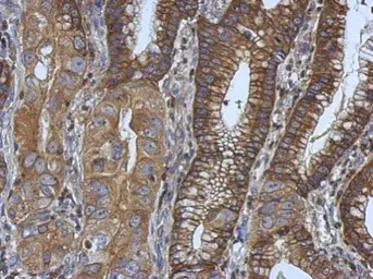 Anti-Ezrin antibody [N2C2], Internal used in IHC (Paraffin sections) (IHC-P). GTX111709