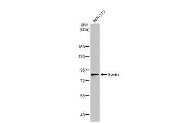 Anti-Ezrin antibody [N2C2], Internal used in Western Blot (WB). GTX111709