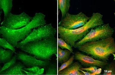 Anti-Ezrin antibody [N2C2], Internal used in Immunocytochemistry/ Immunofluorescence (ICC/IF). GTX111709