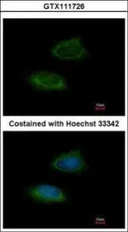 Anti-Adenylate kinase 2 antibody [N1C2] used in Immunocytochemistry/ Immunofluorescence (ICC/IF). GTX111726