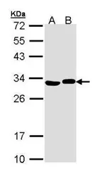 Anti-Adenylate kinase 2 antibody [N1C2] used in Western Blot (WB). GTX111726