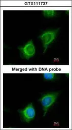 Anti-Adenylate kinase 2 antibody [N1C3-2] used in Immunocytochemistry/ Immunofluorescence (ICC/IF). GTX111737
