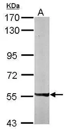Anti-PXK antibody [N2C2], Internal used in Western Blot (WB). GTX111746