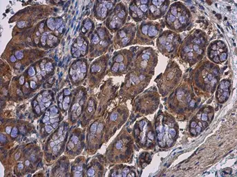 Anti-Calpain 2 antibody [N2C1-2], Internal used in IHC (Paraffin sections) (IHC-P). GTX111809