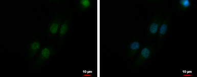 Anti-Mre11 antibody [C1C3-2] used in Immunocytochemistry/ Immunofluorescence (ICC/IF). GTX111814