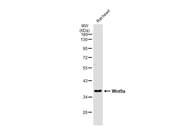 Anti-Wnt9a antibody [N1N2], N-term used in Western Blot (WB). GTX111855