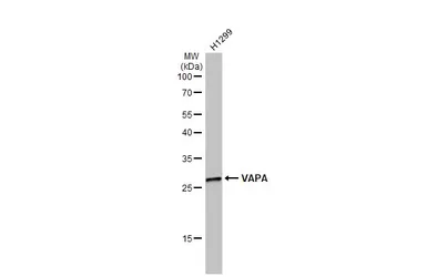 Anti-VAPA antibody [N1N3] used in Western Blot (WB). GTX111859