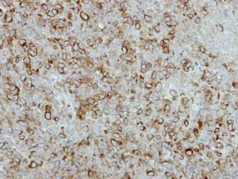 Anti-FGF21 antibody [N3C3] used in IHC (Paraffin sections) (IHC-P). GTX111877