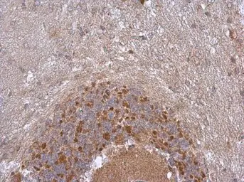 Anti-NDUFB5 antibody used in IHC (Paraffin sections) (IHC-P). GTX111880