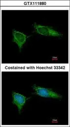 Anti-NDUFB5 antibody used in Immunocytochemistry/ Immunofluorescence (ICC/IF). GTX111880
