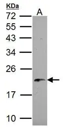 Anti-NDUFB5 antibody used in Western Blot (WB). GTX111880