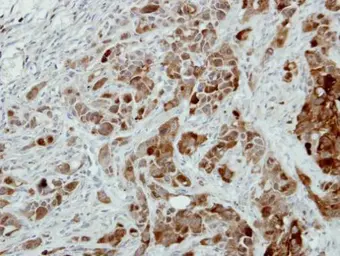 Anti-PRX III antibody [C2C3], C-term used in IHC (Paraffin sections) (IHC-P). GTX111887
