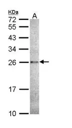 Anti-Caspase 14 antibody used in Western Blot (WB). GTX111888