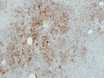 Anti-RPL17 antibody [N1C3-2] used in IHC (Paraffin sections) (IHC-P). GTX111934