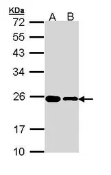 Anti-RPL17 antibody [N1C3-2] used in Western Blot (WB). GTX111934
