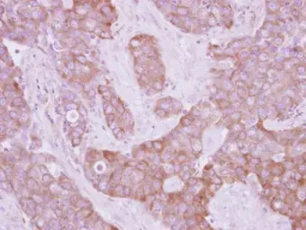 Anti-LOK antibody [N1N2], N-term used in IHC (Paraffin sections) (IHC-P). GTX111951
