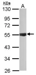 Anti-IPPK antibody [N2C2], Internal used in Western Blot (WB). GTX111968