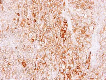 Anti-FLJ32786 antibody [N2C1], Internal used in IHC (Paraffin sections) (IHC-P). GTX111979