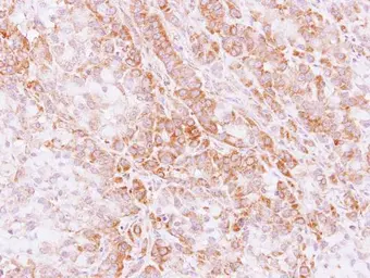Anti-STK32C antibody [N2C3] used in IHC (Paraffin sections) (IHC-P). GTX111982