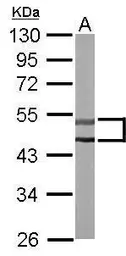 Anti-STK32C antibody [N2C3] used in Western Blot (WB). GTX111982