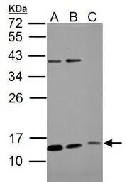 Anti-ROPN1B antibody used in Western Blot (WB). GTX112010