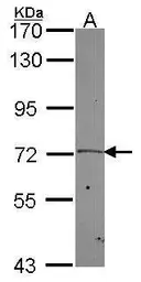 Anti-PLK2 antibody [C1C3] used in Western Blot (WB). GTX112022