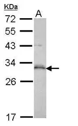 Anti-p53DINP1 antibody [N1N2], N-term used in Western Blot (WB). GTX112066