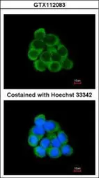 Anti-PECR antibody [C2C3], C-term used in Immunocytochemistry/ Immunofluorescence (ICC/IF). GTX112083