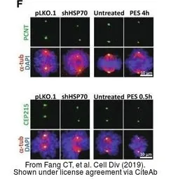 Anti-alpha Tubulin antibody used in Immunocytochemistry/ Immunofluorescence (ICC/IF). GTX112141