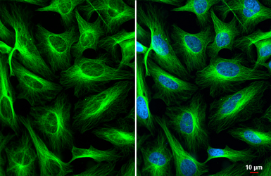 Anti-alpha Tubulin antibody used in Immunocytochemistry/ Immunofluorescence (ICC/IF). GTX112141