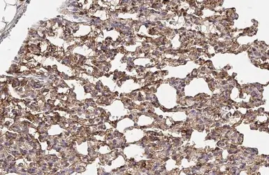Anti-alpha Tubulin antibody used in IHC (Paraffin sections) (IHC-P). GTX112141