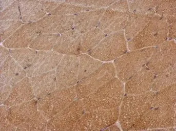 Anti-SH2D3C antibody [C2C3], C-term used in IHC (Paraffin sections) (IHC-P). GTX112162