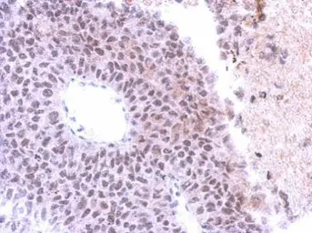 Anti-SAP130 antibody [C2C3], C-term used in IHC (Paraffin sections) (IHC-P). GTX112169
