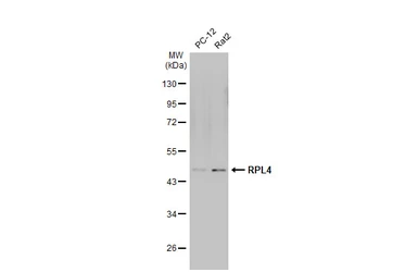 Anti-RPL4 antibody used in Western Blot (WB). GTX112184