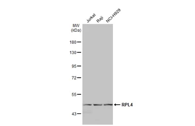 Anti-RPL4 antibody used in Western Blot (WB). GTX112184