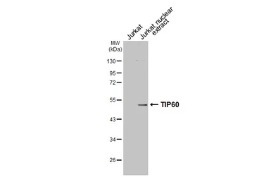 Anti-TIP60 antibody used in Western Blot (WB). GTX112198