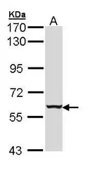 Anti-Cytokeratin 4 antibody used in Western Blot (WB). GTX112211