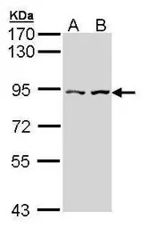 Anti-CTNNAL1 antibody [N3C2], Internal used in Western Blot (WB). GTX112226