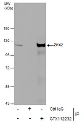 Anti-ZHX2 antibody [C1C3] used in Immunoprecipitation (IP). GTX112232