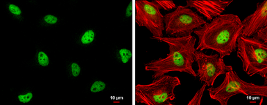 Anti-ZHX2 antibody [C1C3] used in Immunocytochemistry/ Immunofluorescence (ICC/IF). GTX112232