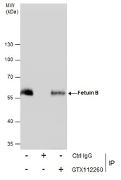 Anti-Fetuin B antibody used in Immunoprecipitation (IP). GTX112260